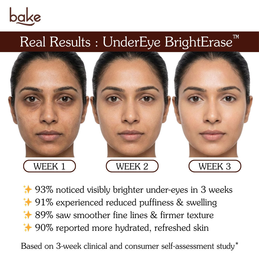 BrightErase Under Eye Cream – 2% Caffeine for Under-Eye Darkness, Puffiness & Fine Lines