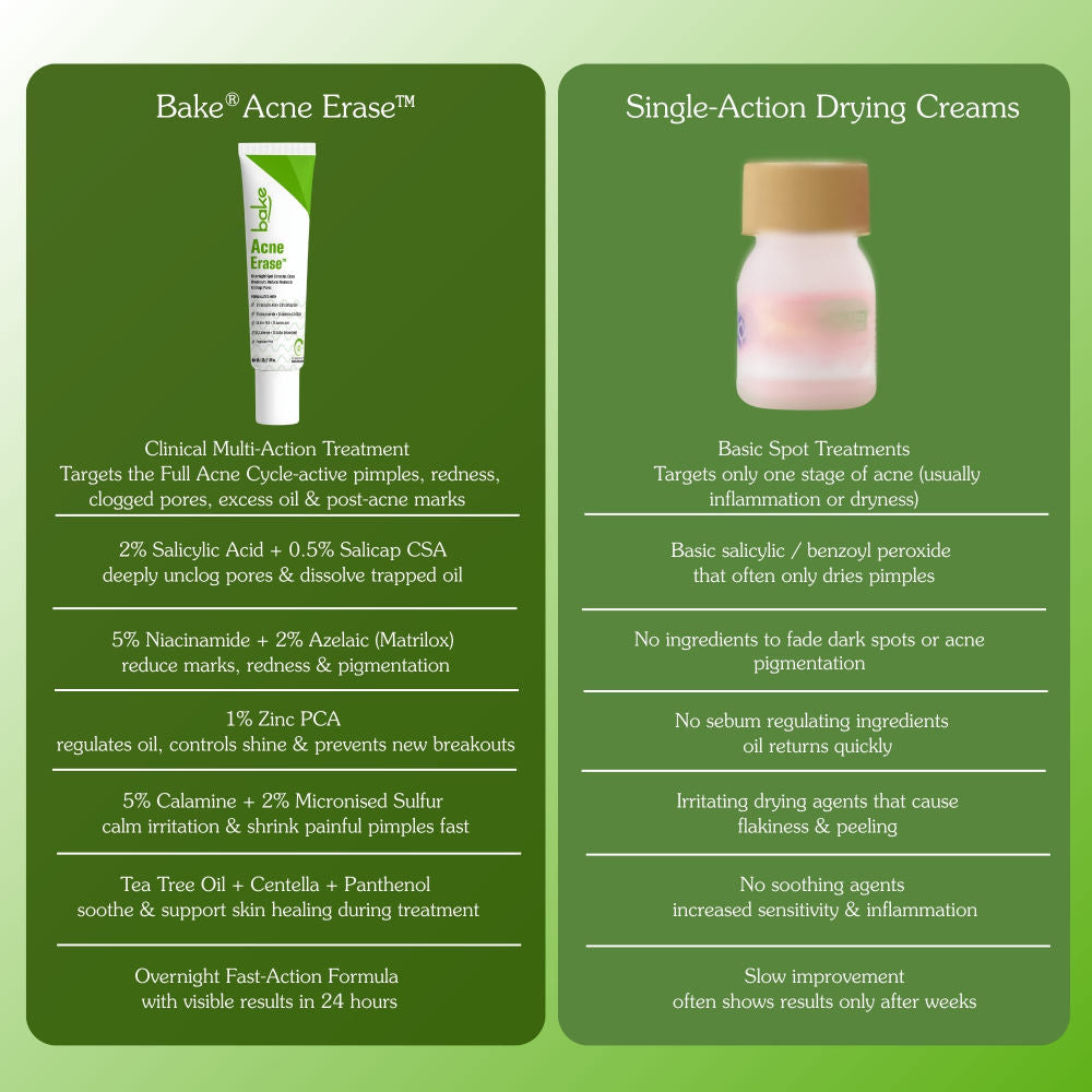 Acne Spot Serum Gel - Overnight Corrector For Pimples, Breakouts, Redness & Clogged Pores