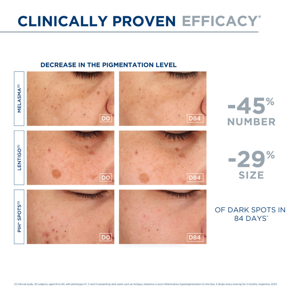Brightening Serum - Pigmentbio C-Concentrate