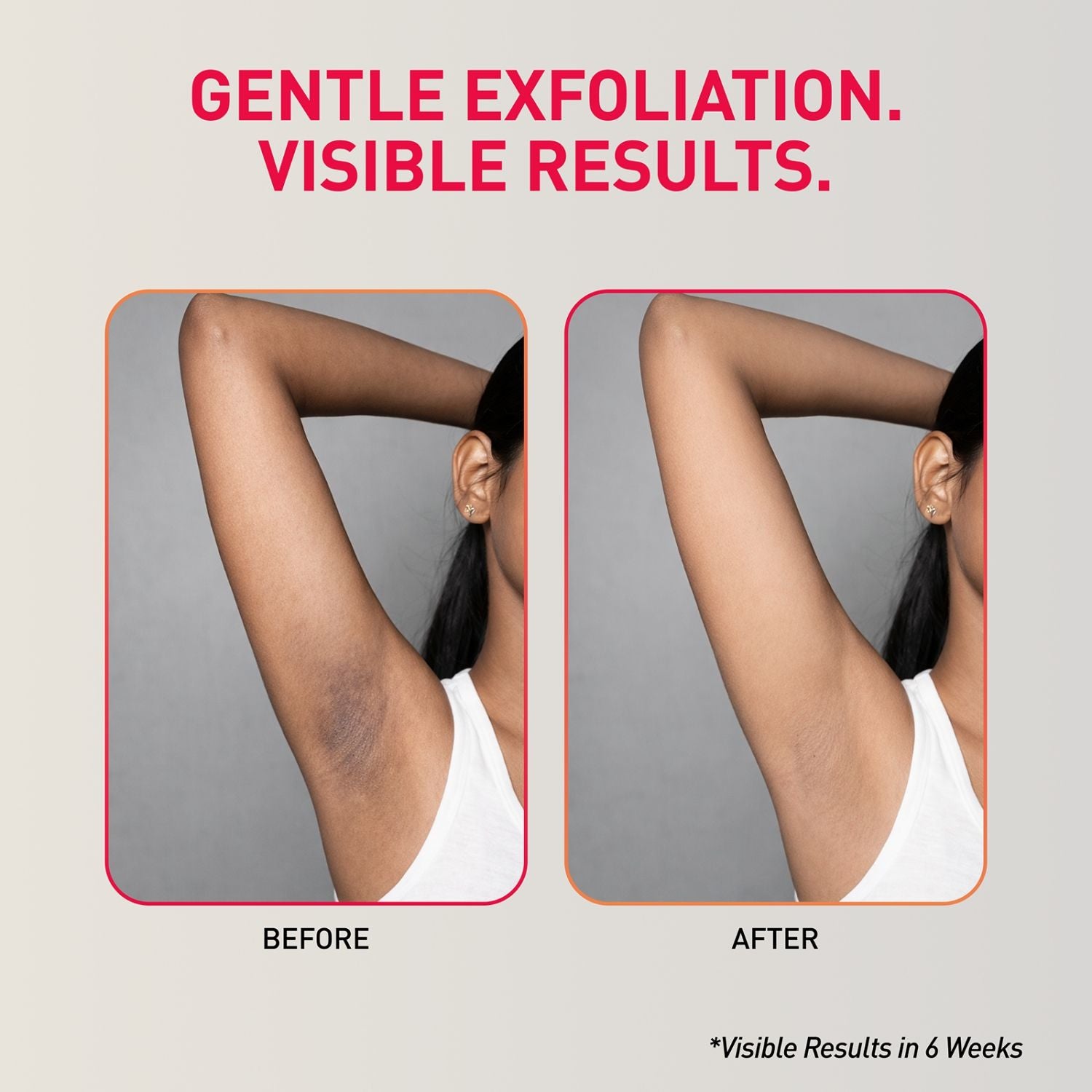 7% AHA BHA Underarm Mist, Treats Pigmentation & Odour - Lactic, Mandelic & Salicylic Acid