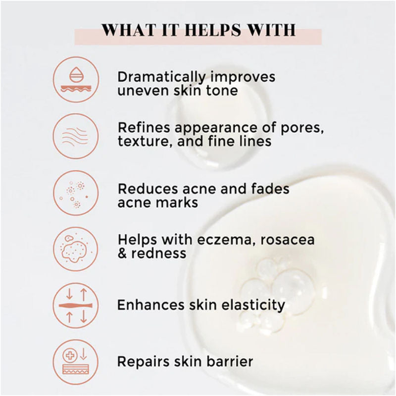10% Niacinamide Face Serum For Acne & Acne Marks, Blemishes, Pigmentation & Enlarged Pores