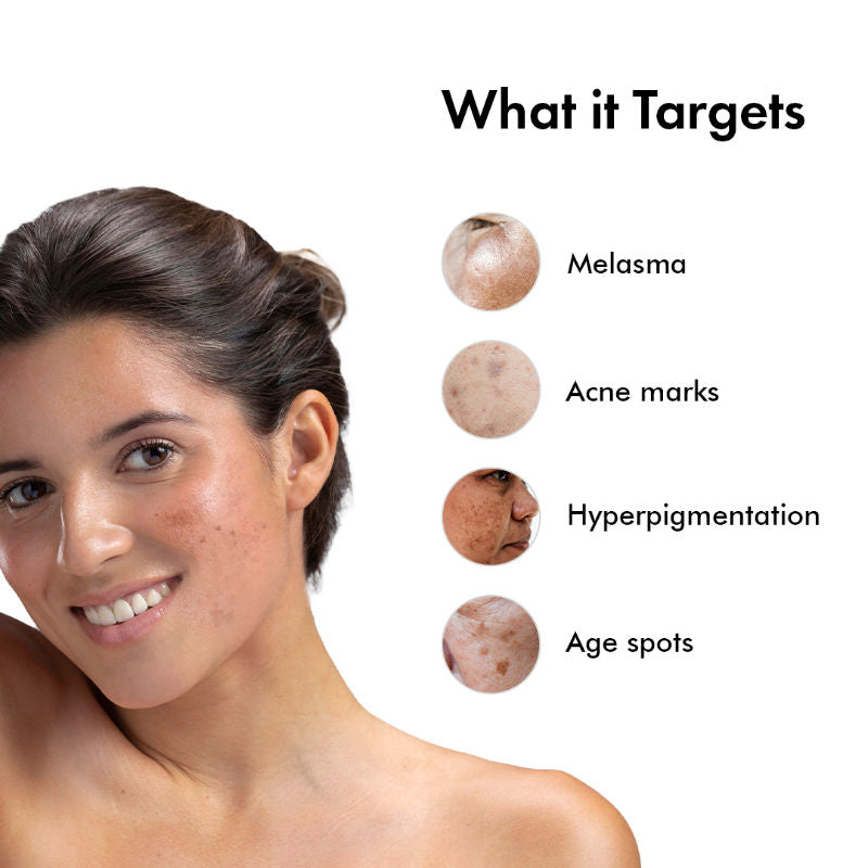 Advance Pigmentation Face Serum with Arbutin +Tranexamic Acid, Fights Hyperpigmentation