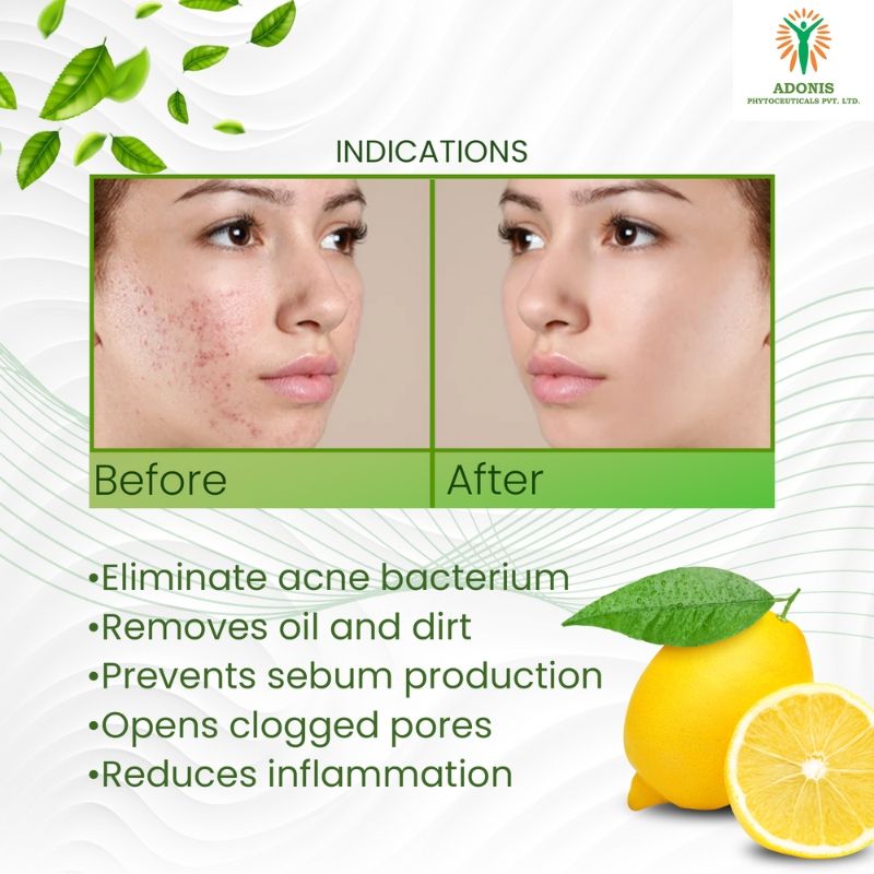 Unisex Ds Anti Acne Face Wash Cleanser With Salicylic Acid & Minerals For Oil Control & Acne