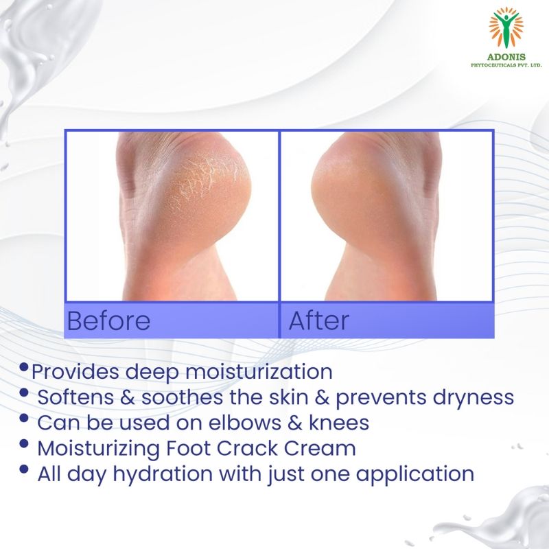 Unisex Ds Soft Cream Foot Repair Cream With Urea & Lactic Acid For Cracked Heels, Smooth Skin