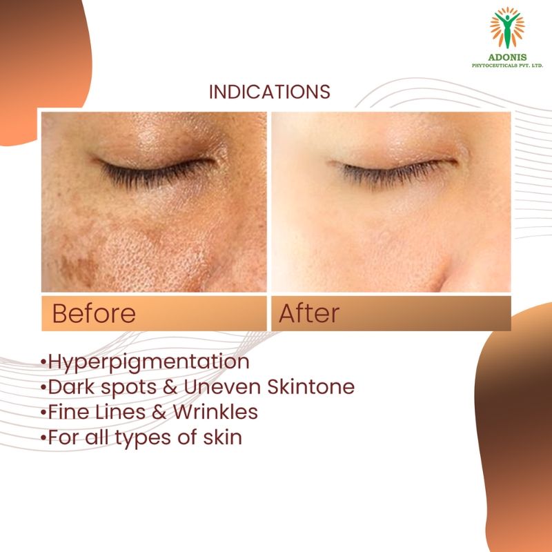 Unisex Adozelic AZ Face Serum with Azelaic Acid & Niacinamide for Pigmentation & Even Tone
