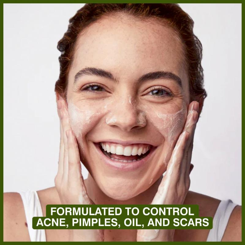 Tea Tree Oil Face Wash For Acne Control