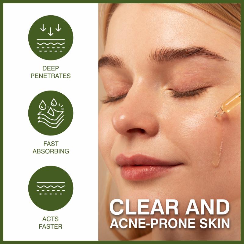Anti-Acne Face Oil Serum With Tea Tree Oil