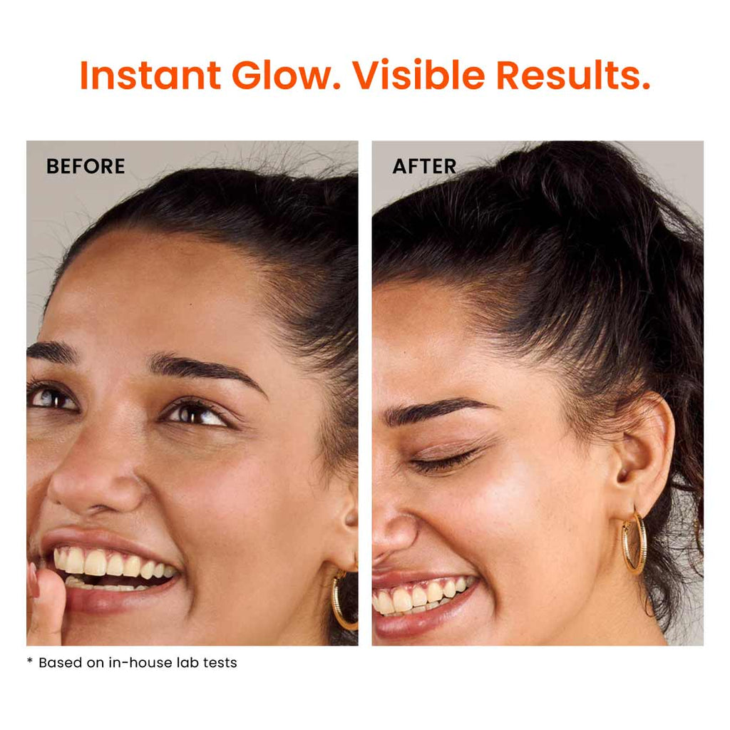 15% Vitamin C Face Serum for Glowing Skin, Pigmentation & Collagen Production