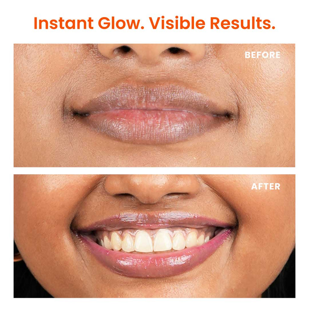 Brightening Lip Balm with Peptides, Vitamin C & Hyaluronic Acid for Dry Lips & Pigmentation