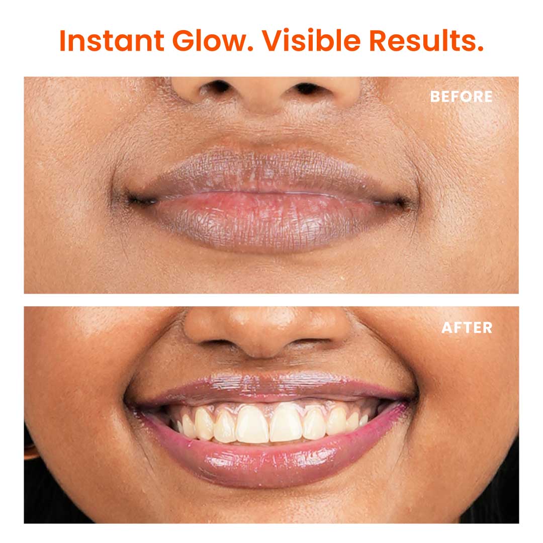 Brightening Lip Balm with Peptides, Vitamin C & Hyaluronic Acid for Dry Lips & Pigmentation