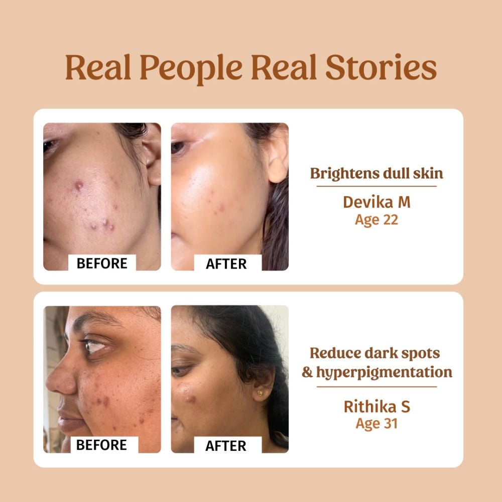 Milk Drops Brightening Serum For Hydrated Skin, Dark Spot Care & Hyperpigmentation