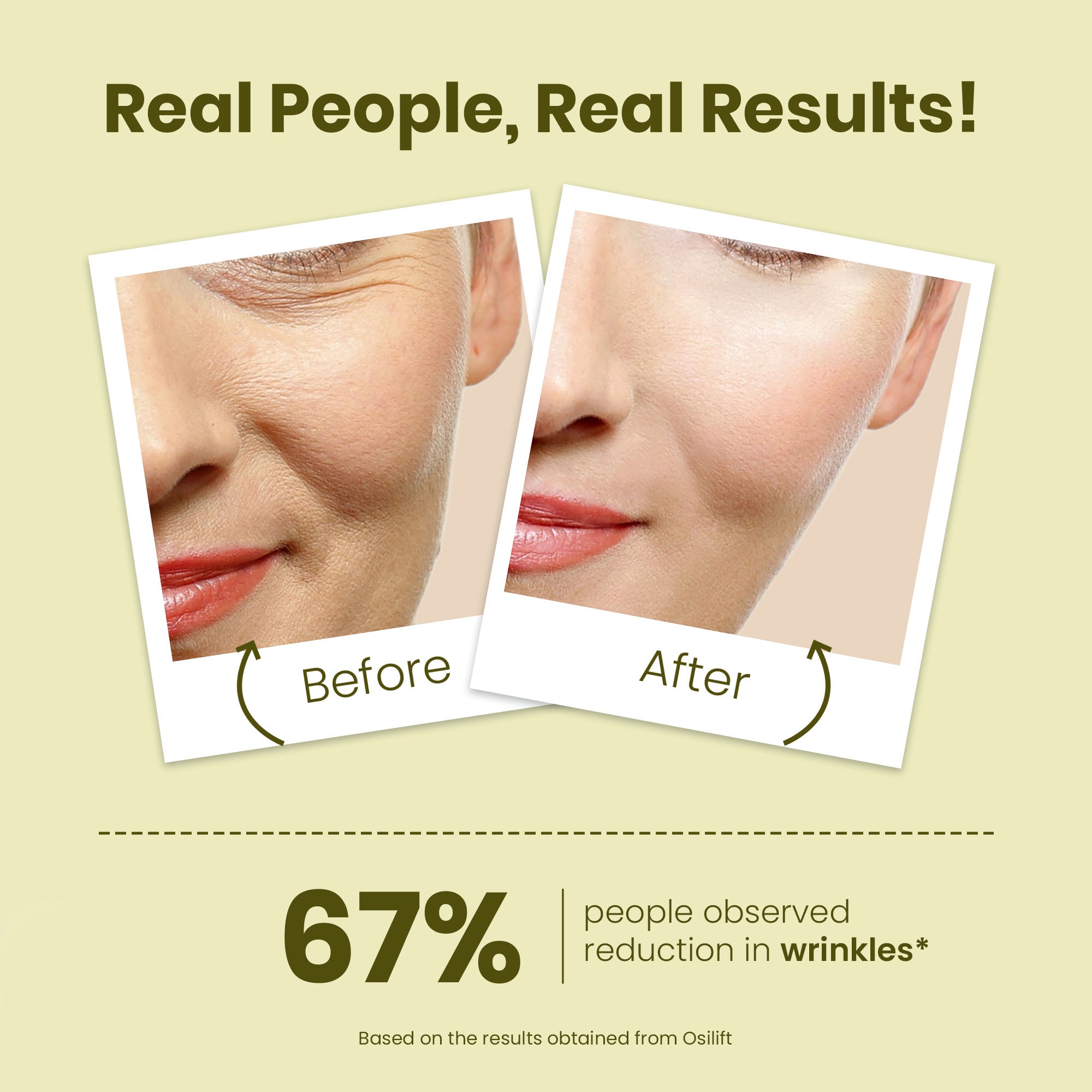 Young Forever Face Serum With Bakuchi, Fights Sign Of Ageing, For Oily & Dry Skin