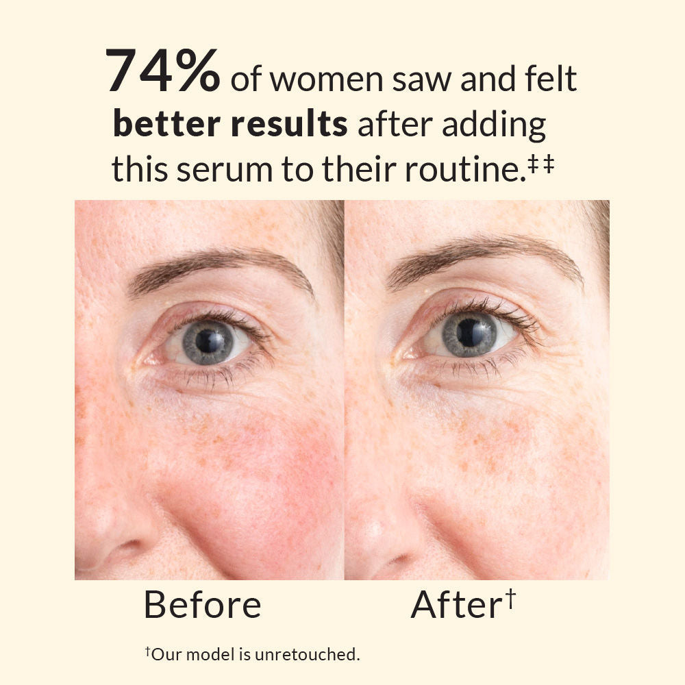 Anew Skin Renewal Power Serum