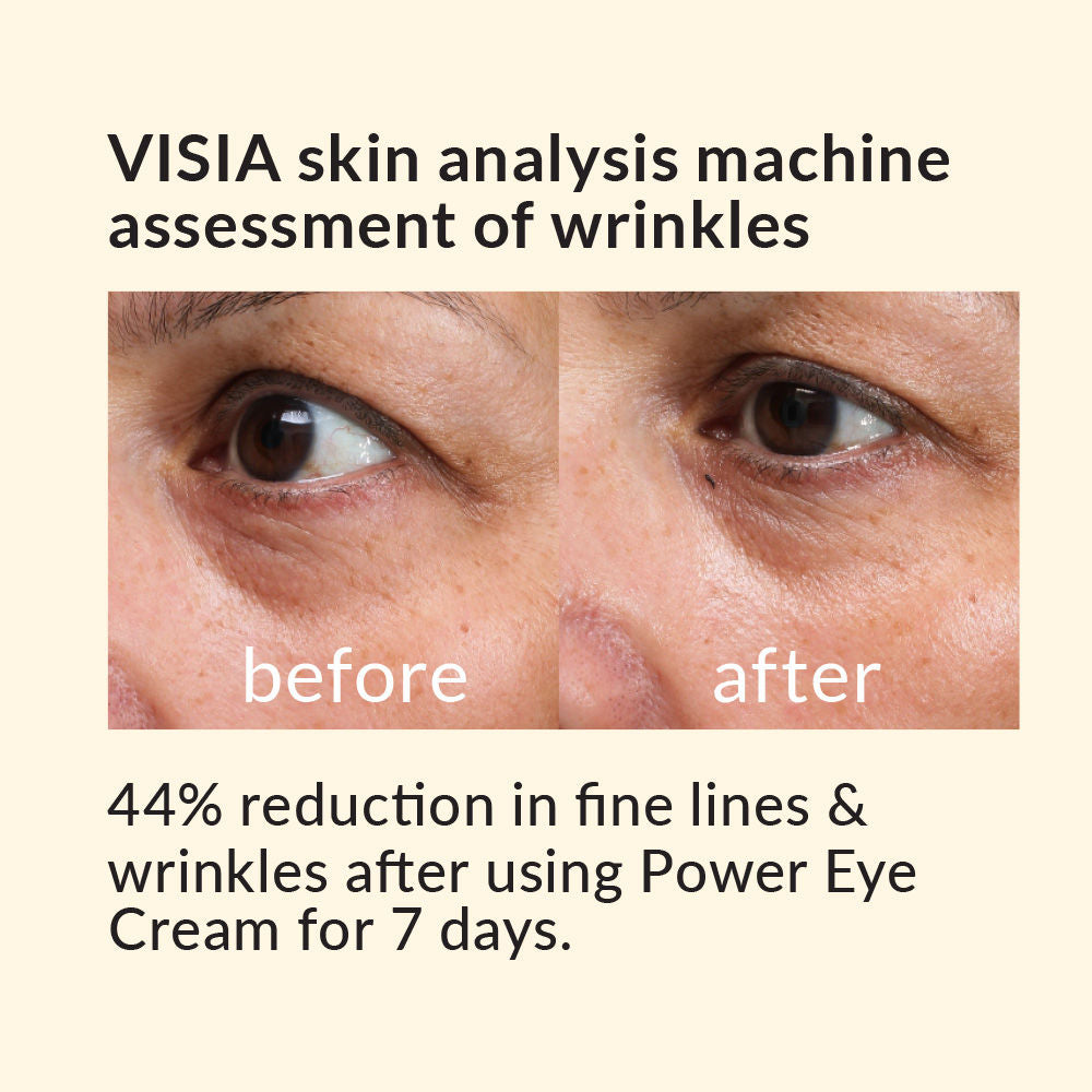 Anew Skin Renewal Power Eye Cream