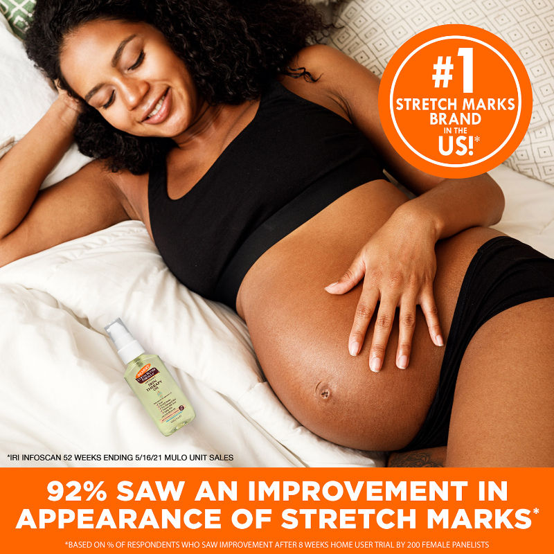 Cocoa Butter Skin Therapy Oil For Scars, Stretch Marks, Uneven Skin Tone & Ageing Skin