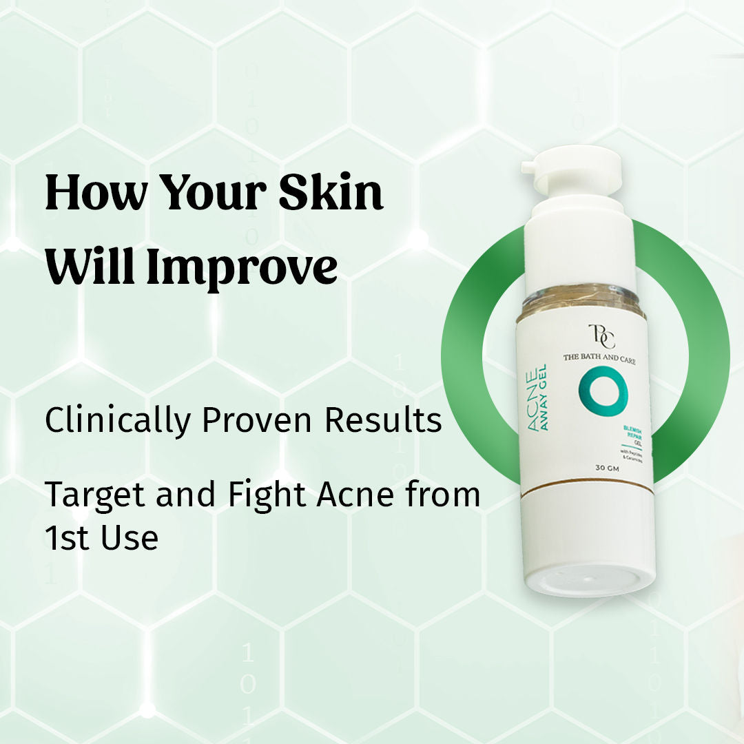 Acne Away Gel Anti Acne Face Gel