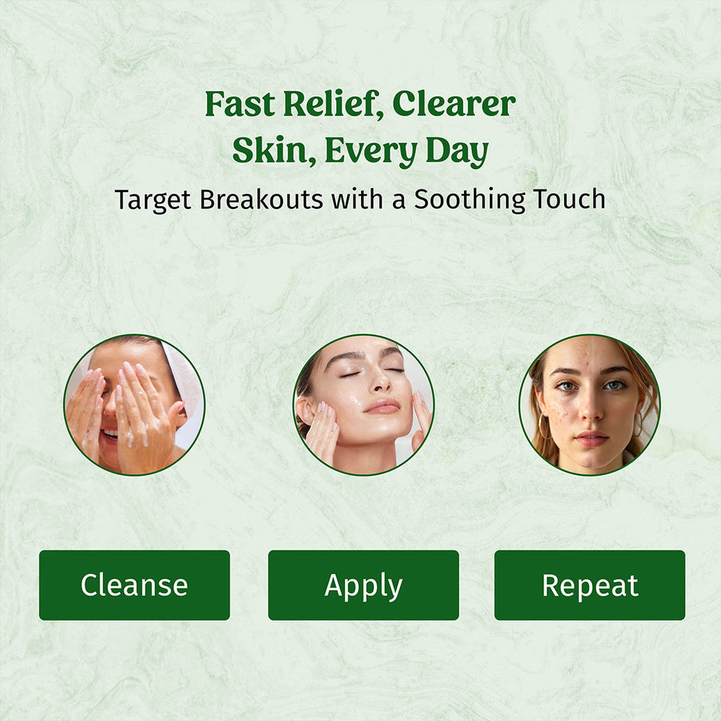Acne Away Gel Anti Acne Face Gel