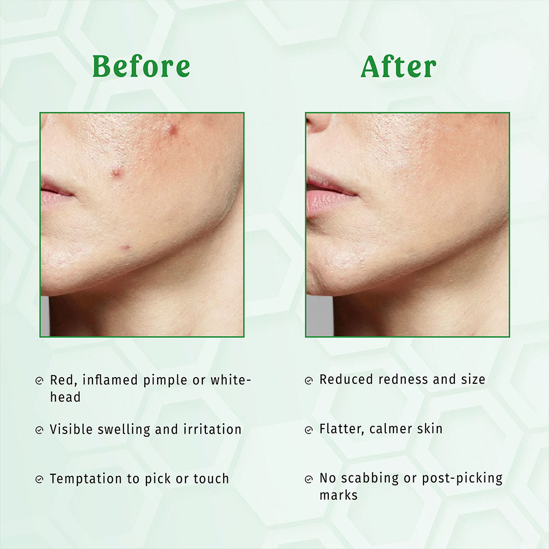 Clear Earth Glow Green Clay Facial Mask