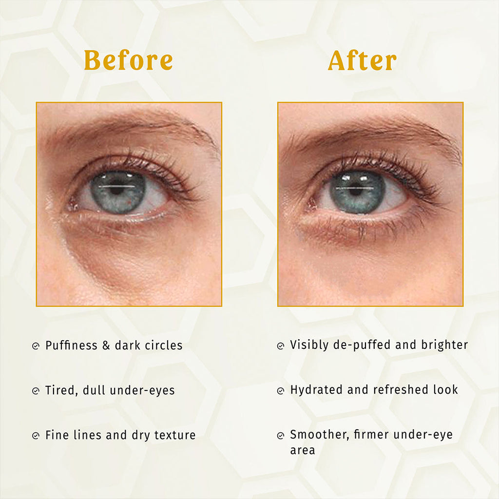 Gold E-Care Gel Eye Mask Reduces Dark Circles Hydrating, Brightening