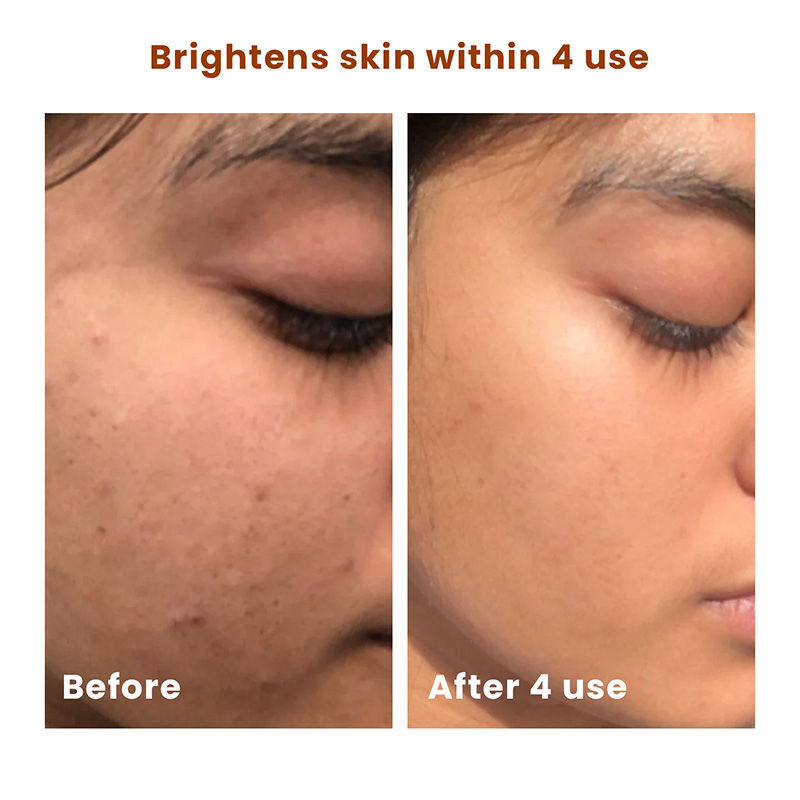 Salicylic Acid Brightening Face Scrub Removes Tan Excess Oil Blackheads & Whiteheads