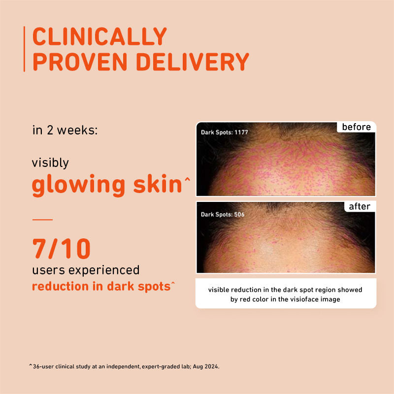15% Vitamin C Glow Face Serum - Dermat Tested To Fight Dark Spots- Pigmentation & Dull Skin