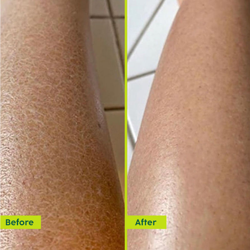 Avocado Ceramide Moisture Rush Luxury Body Butter