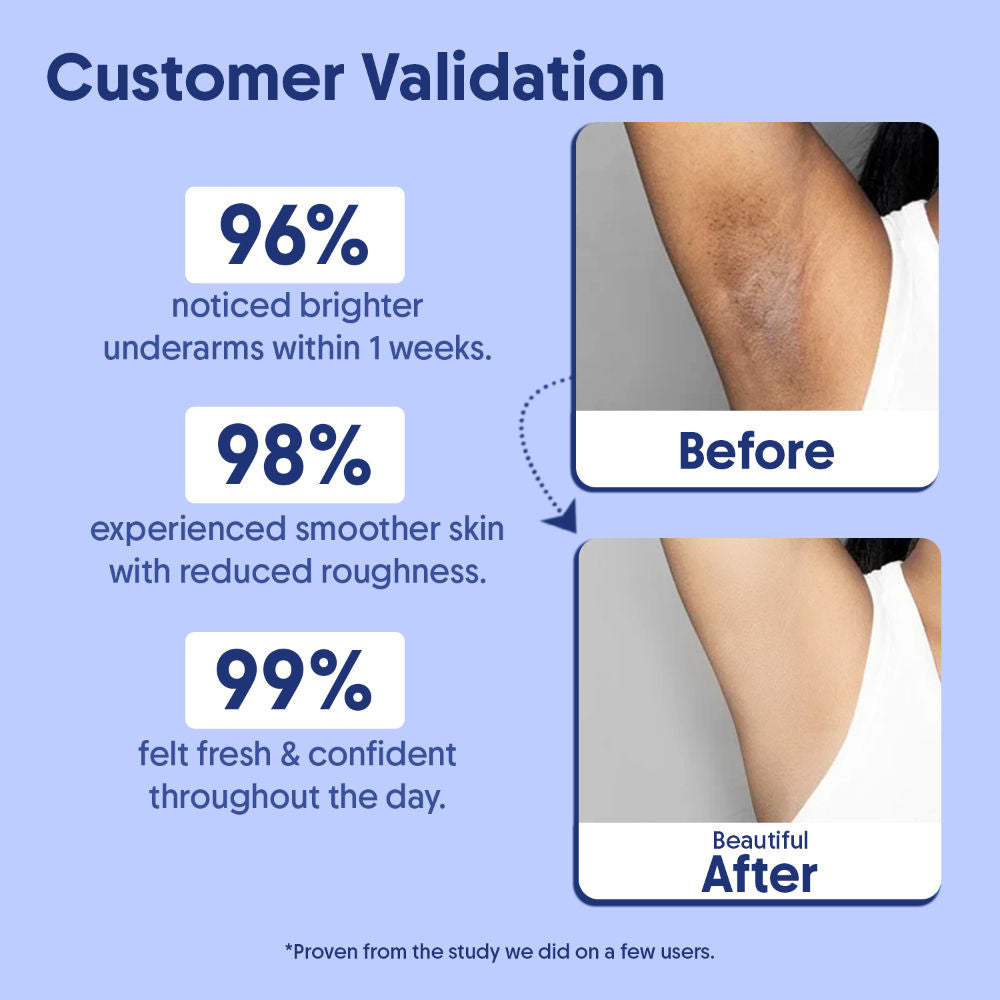 Underarm Roll On - 5% AHA BHA + Kojic Acid For Dark Pigmentation & Odor Control