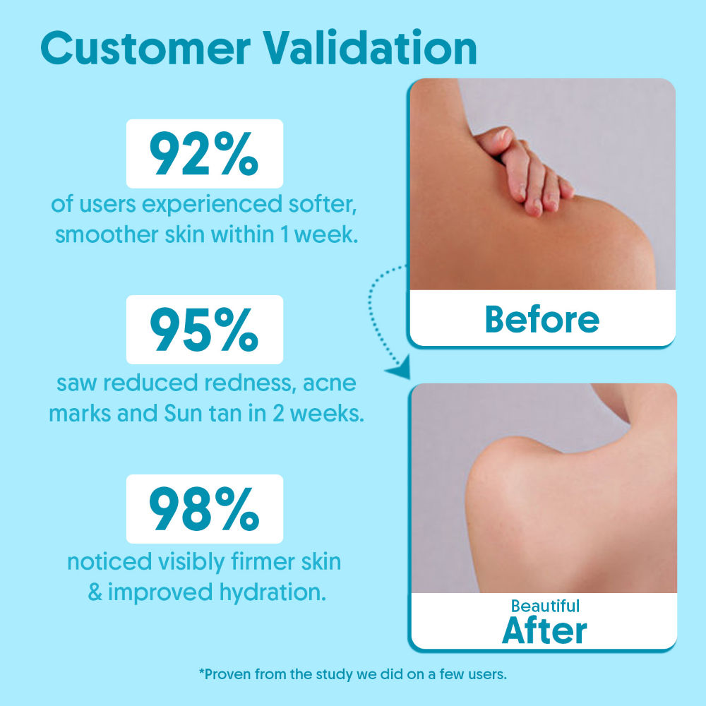 2% Salicylic Acid Exfoliating Body Wash - For Tan Removal, Body Acne & Strawberry Skin