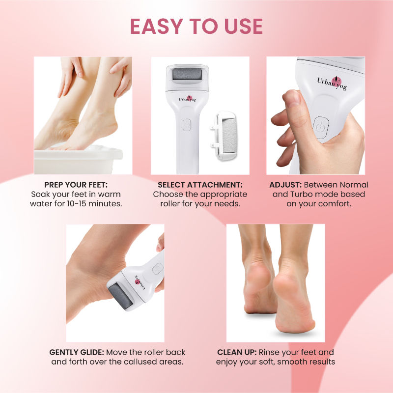 Electric Callus Remover