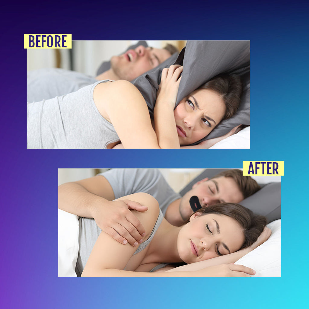 Anti-Snore Sleep Strips For Mouth Breathing