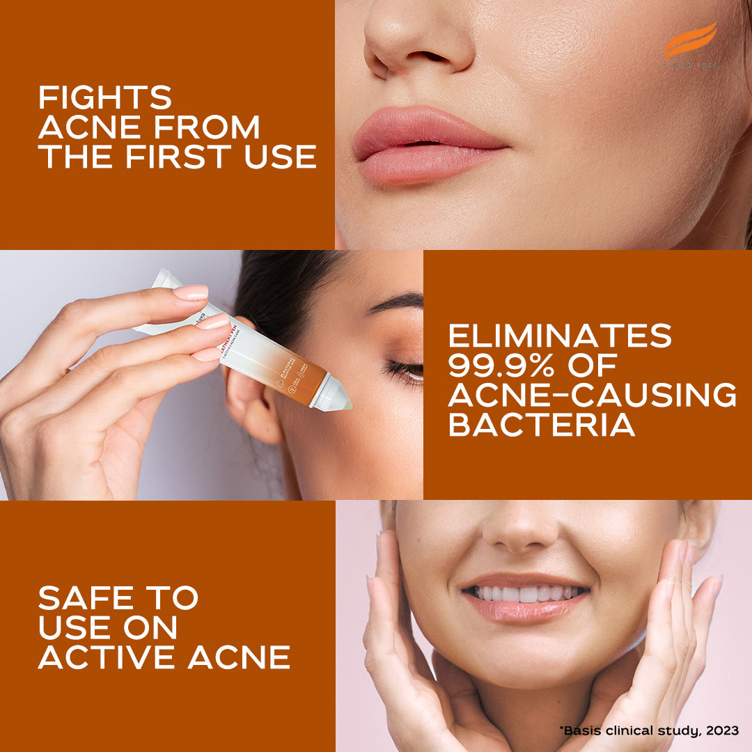 Acne Clear+ Spot Treatment Pen with 2% Natural Salicylic Acid Reducing Acne Size in 24 hrs