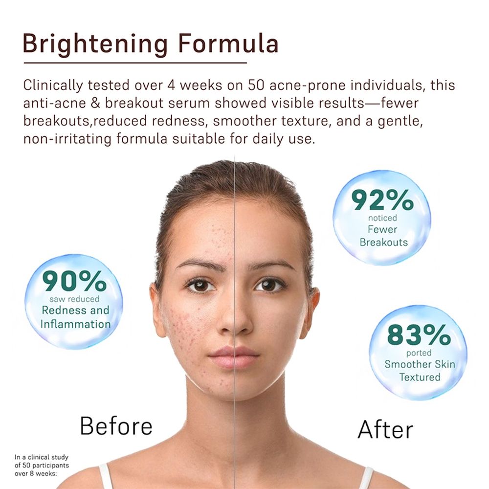 Anti-Acne And Breakouts Face Serum