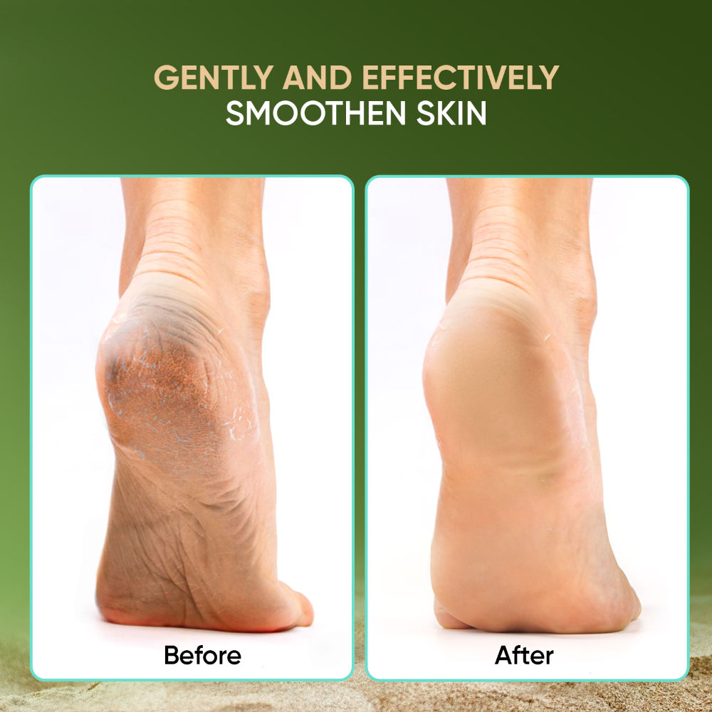 3 In 1 Pedicure Tool- Callus Remover & Pedicure Tool For Wet & Dry Feet - PD 20