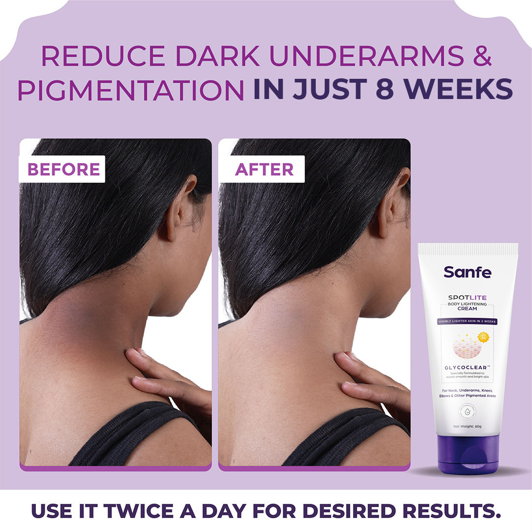 spotlite body lightening Cream