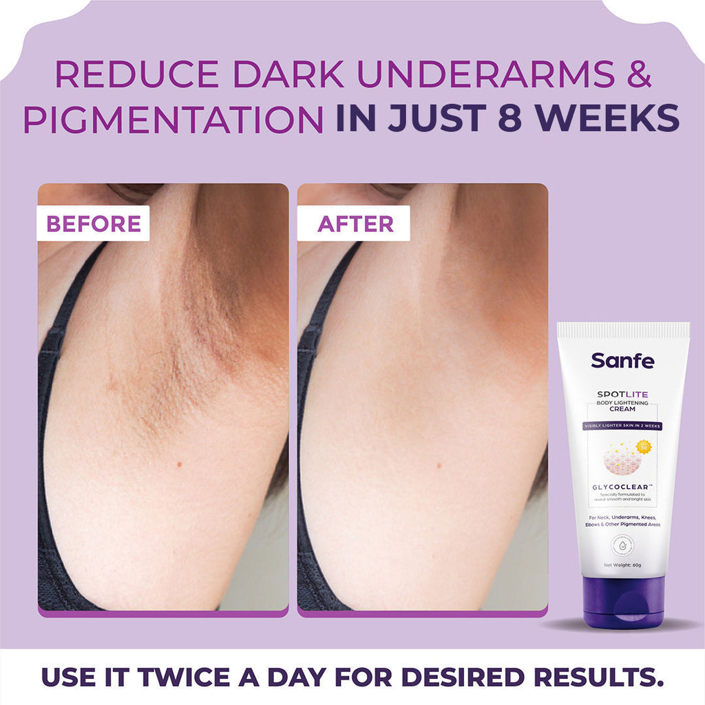 spotlite body lightening Cream