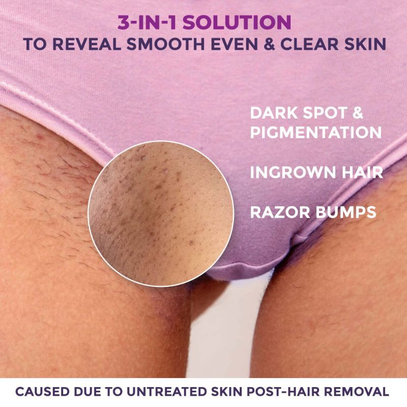 Spotlite Ingrown Hair & Bumps Clearing Body Scrub For Dark Underarms, 10% Glycolic Acid
