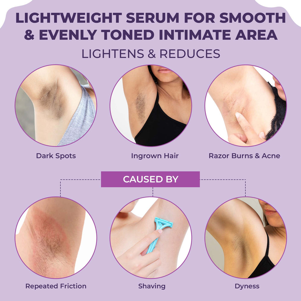 Spotlite Sensitive Body Serum For Dark Underarms, 2% Glycolic Acid & 4% Niacinamide