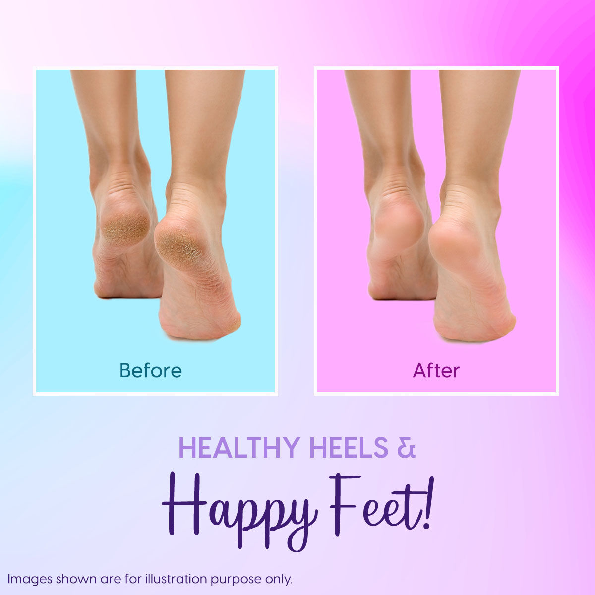Cotton Silicone Moisturising Gel Heel Socks for Cracked & Dry Heels Foot Care for Softer Feet