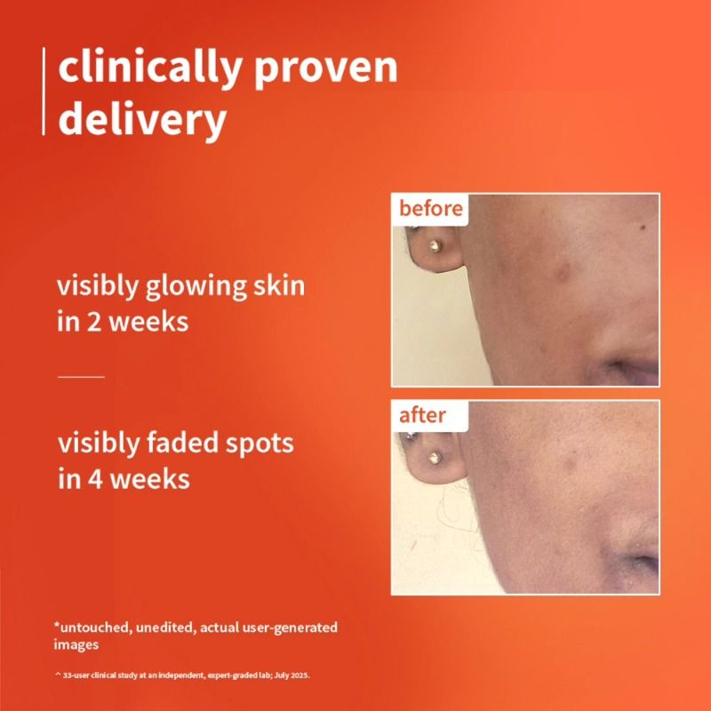 1% Vitamin C Ultra-Light-Glow Boosting Gel Cream