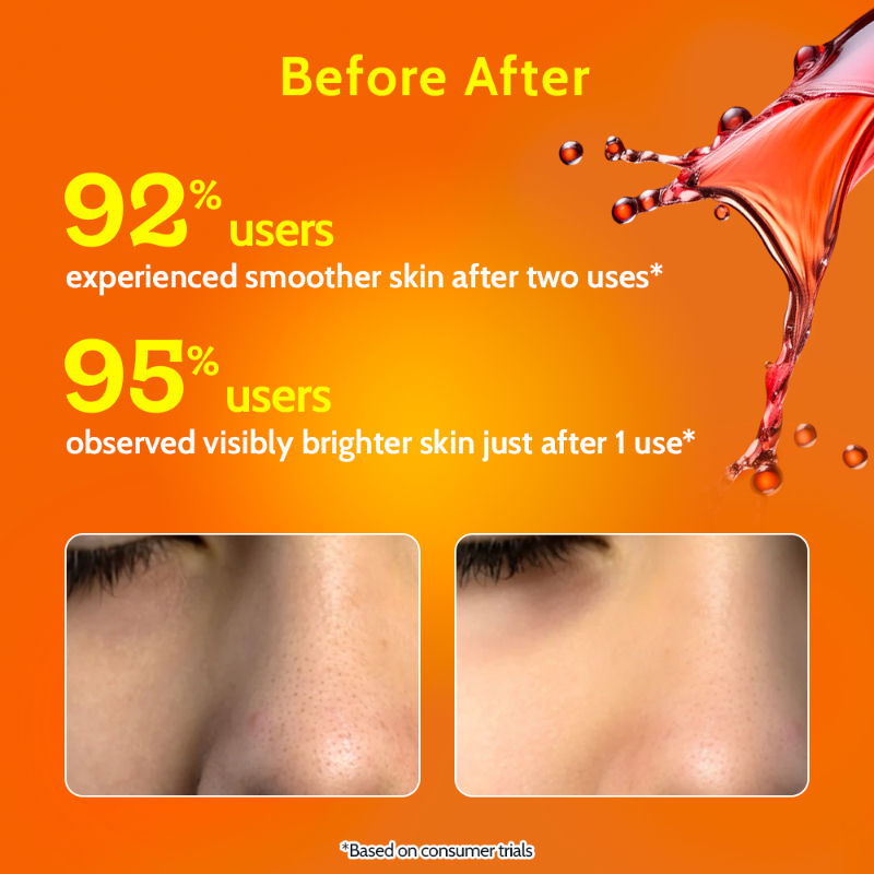 26% AHA 2% BHA 4% PHA Exfoliating Peeling Solution Aha Bha Peeling Solution
