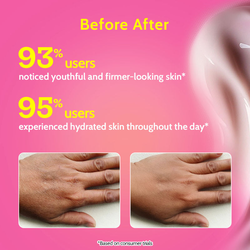 Anti-Aging Body Lotion With 4% Retinol, Niacinamide & Zemea