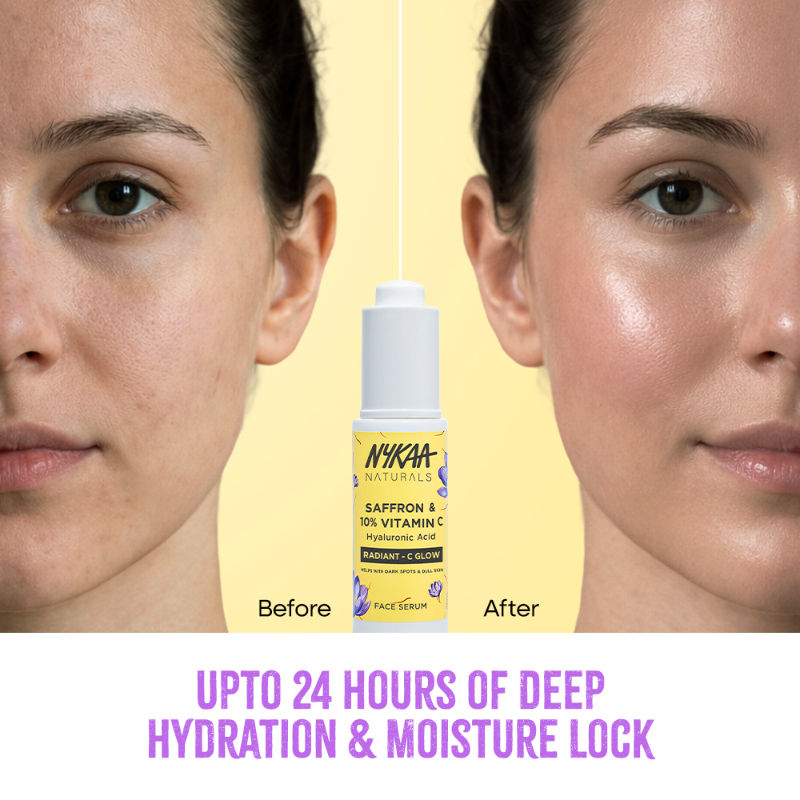 Nykaa Naturals 10% Vitamin C Radiant-C Glow Serum to Fade Dark Spots & Brighten Dull, Tired Skin