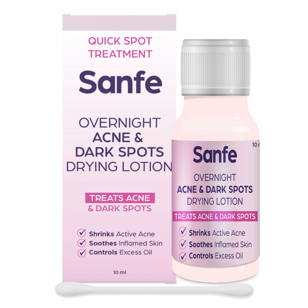 Overnight Acne Drying Lotion, Salicylic Acid & Calamine Acne Spot Corrector, Pimple Clearing