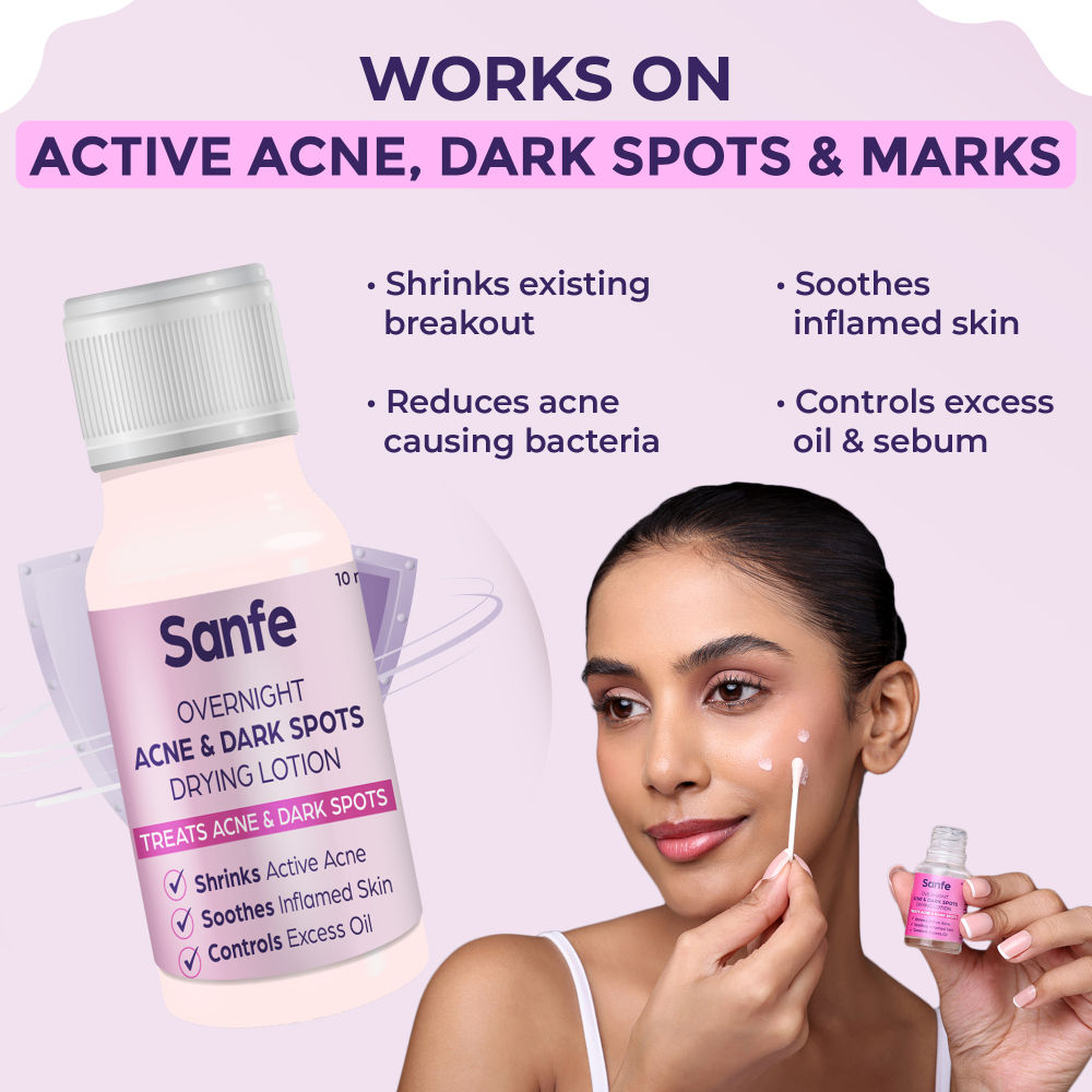 Overnight Acne Drying Lotion, Salicylic Acid & Calamine Acne Spot Corrector, Pimple Clearing