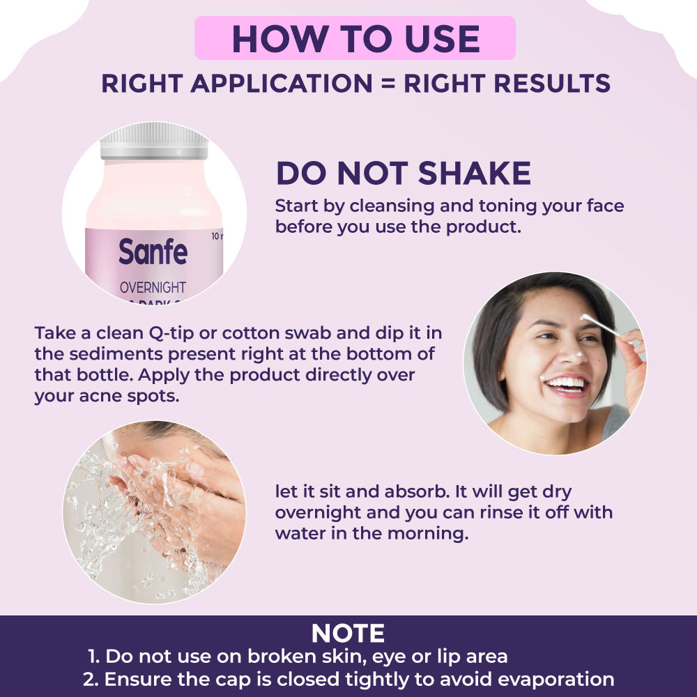 Overnight Acne Drying Lotion, Salicylic Acid & Calamine Acne Spot Corrector, Pimple Clearing