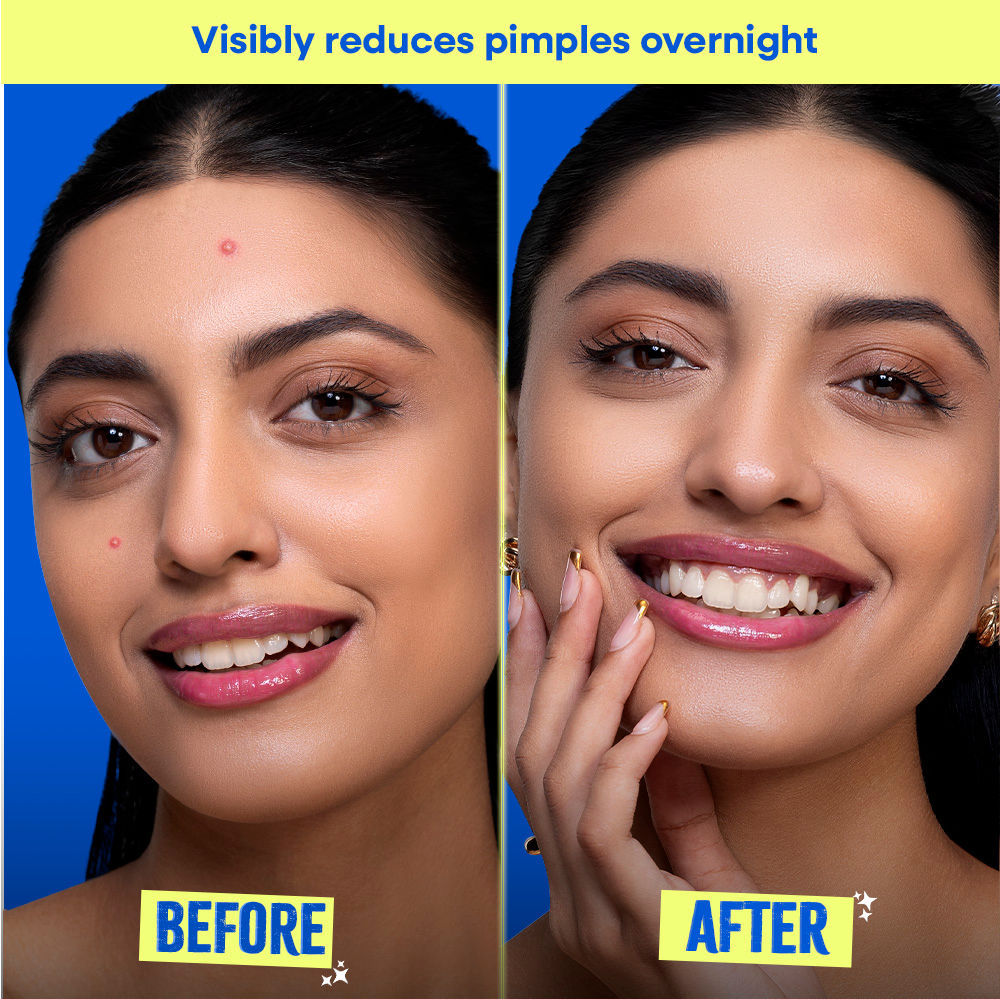 Goodbye Blemish Acne Spot Patches