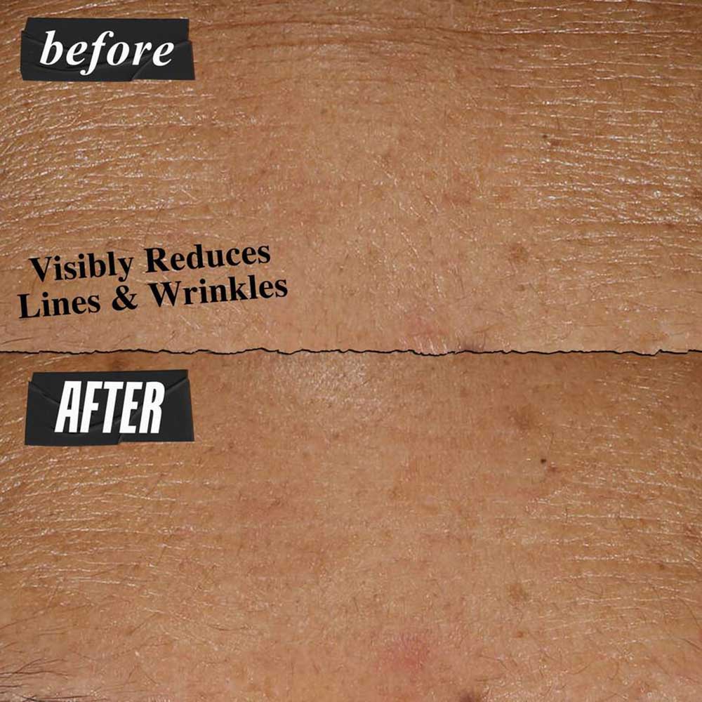 Micro-Dose Anti-Aging Retinol Serum