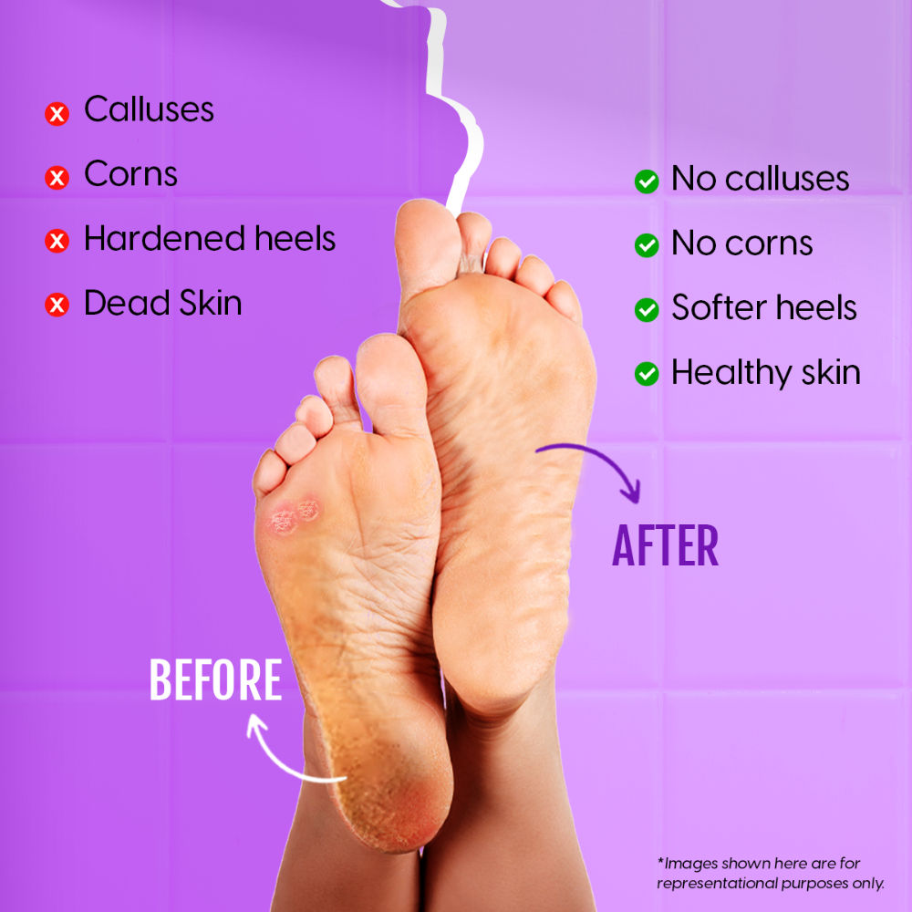 Foot Filer Metal Scrubber Scraper Pedicure Rasp Dead Skin & Callus Remover Tool For Heels