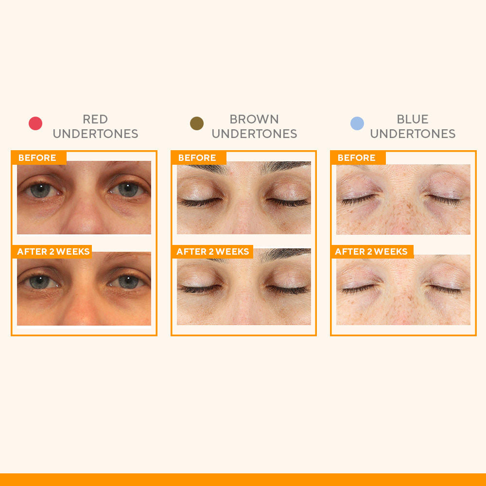 Vitamin C Eyes Dark Circle Corrector