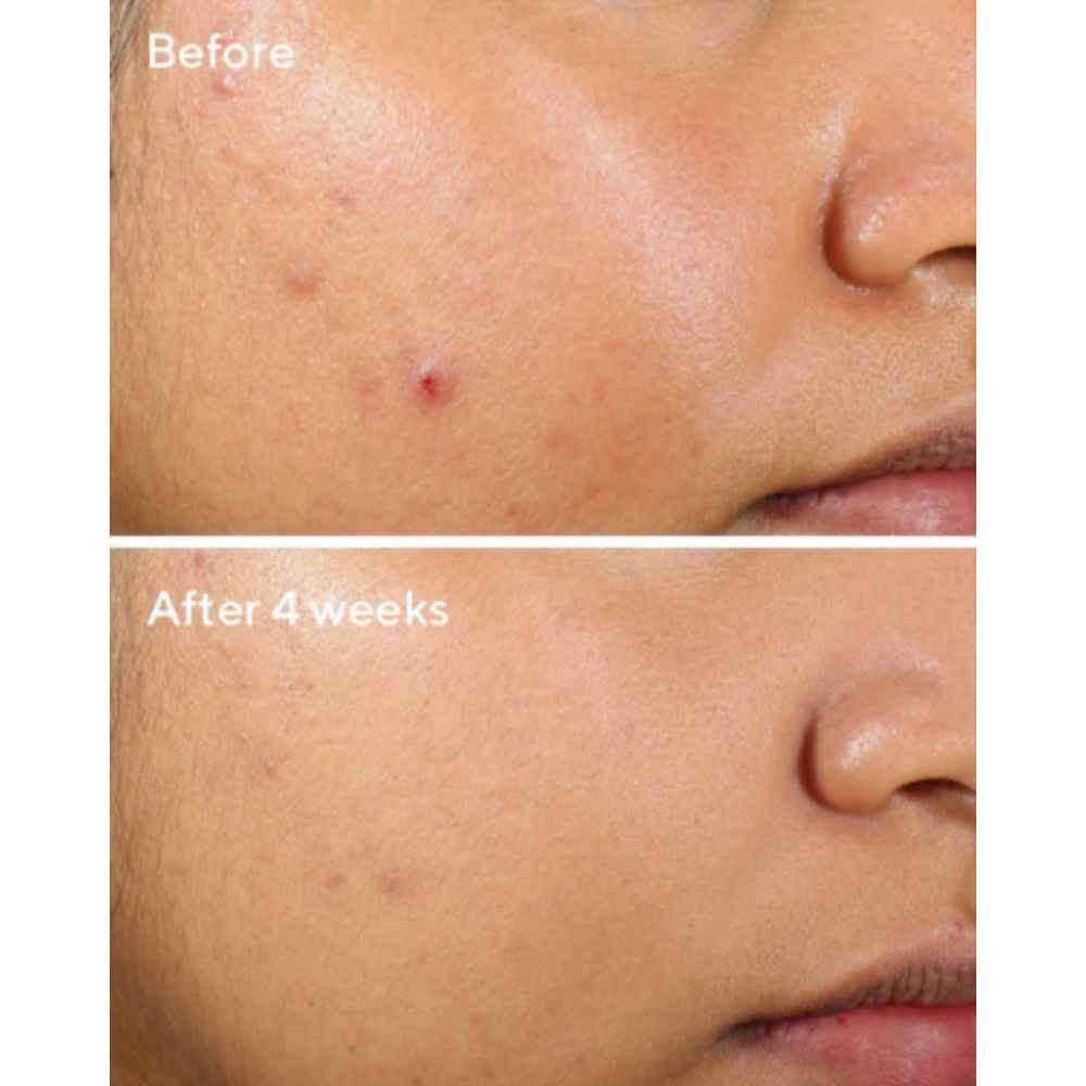 Clarifying Water Gel